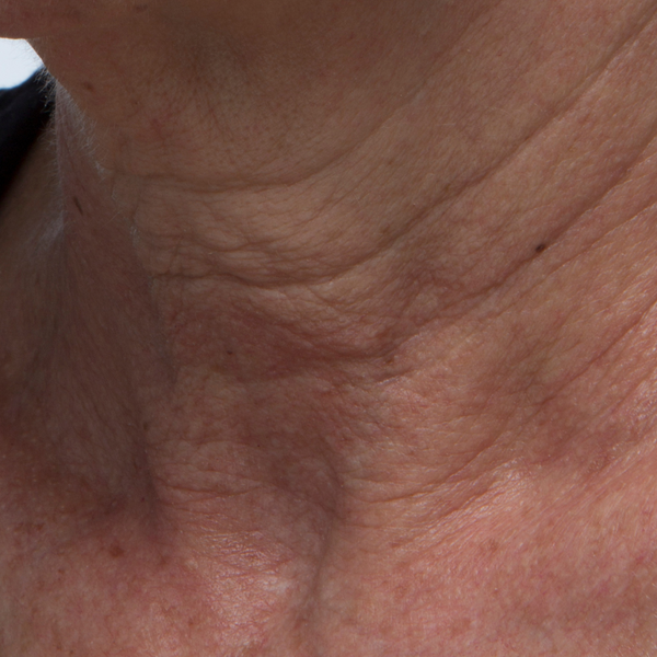10 minutes after applying Resurfacing Enzyme Polish